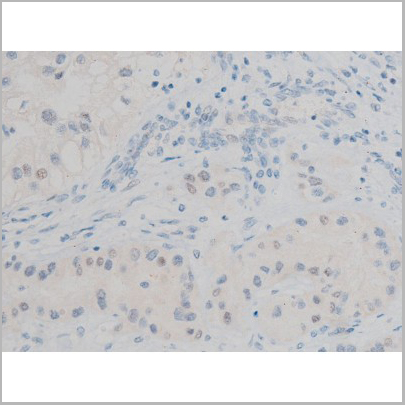 product-image-AAA31013_IHC4.jpg