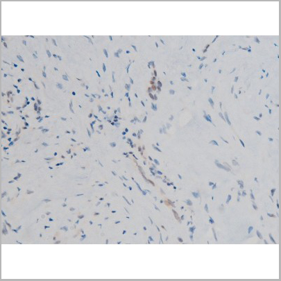 product-image-AAA31013_IHC5.jpg