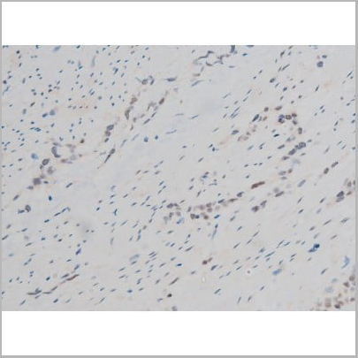 product-image-AAA31013_IHC6.jpg