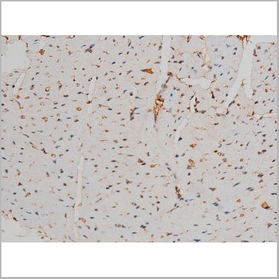 product-image-AAA31013_IHC7.jpg