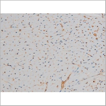 product-image-AAA31013_IHC8.jpg