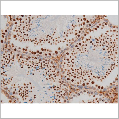 product-image-AAA31013_IHC9.jpg