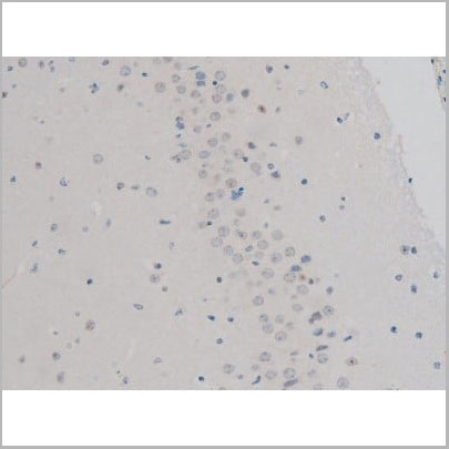 product-image-AAA31014_IHC10.jpg