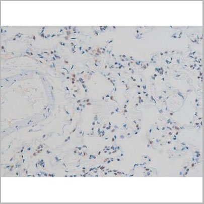 product-image-AAA31014_IHC11.jpg