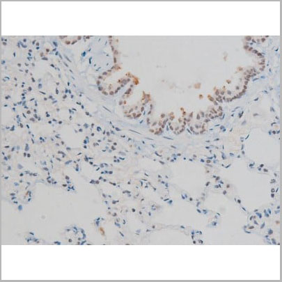 product-image-AAA31014_IHC12.jpg