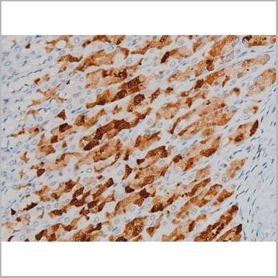 product-image-AAA31014_IHC13.jpg