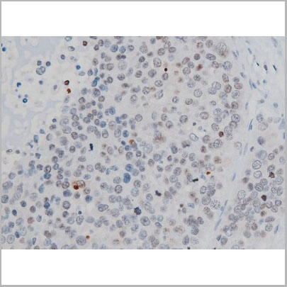 product-image-AAA31014_IHC3.jpg
