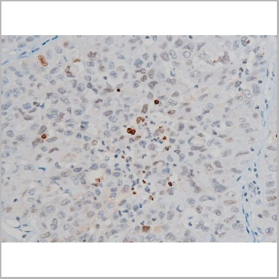 product-image-AAA31014_IHC4.jpg