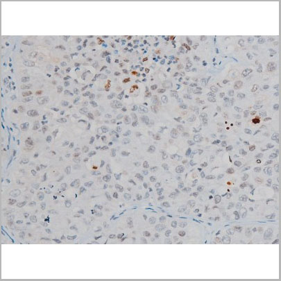 product-image-AAA31014_IHC5.jpg