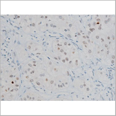 product-image-AAA31014_IHC6.jpg