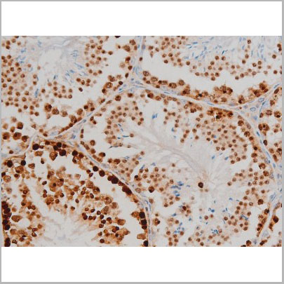product-image-AAA31014_IHC7.jpg