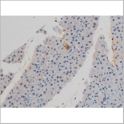 product-image-AAA31014_IHC9.jpg