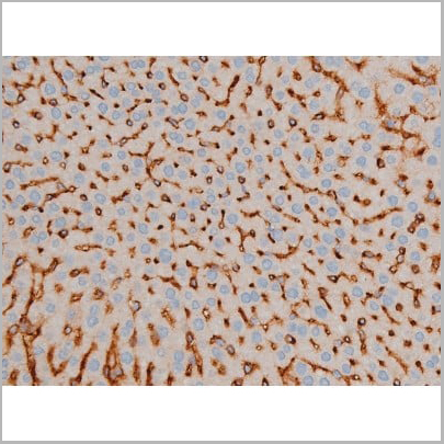product-image-AAA31015_IHC10.jpg