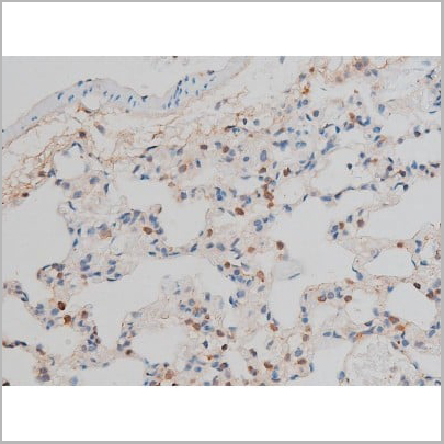 product-image-AAA31015_IHC12.jpg