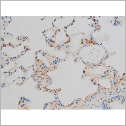 product-image-AAA31015_IHC13.jpg