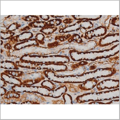 product-image-AAA31015_IHC14.jpg