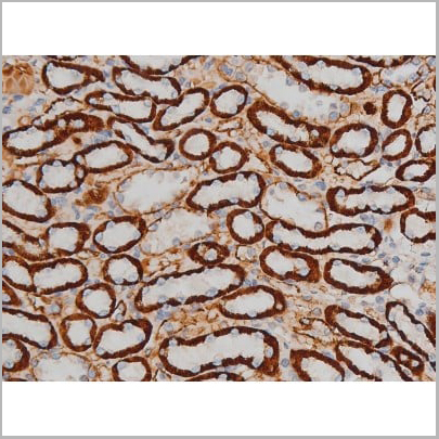 product-image-AAA31015_IHC15.jpg