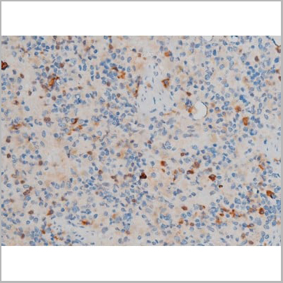 product-image-AAA31015_IHC16.jpg