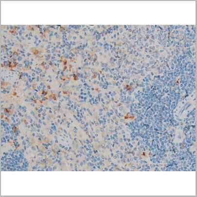 product-image-AAA31015_IHC17.jpg