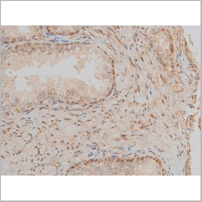 product-image-AAA31015_IHC4.jpg