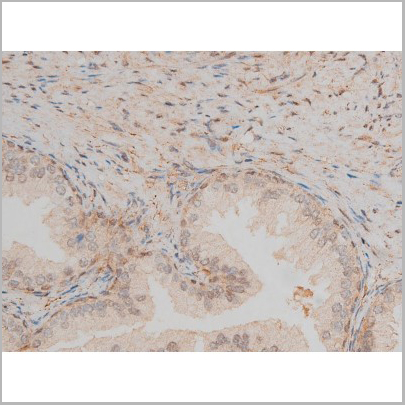 product-image-AAA31015_IHC5.jpg