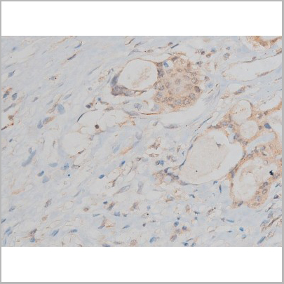 product-image-AAA31015_IHC6.jpg