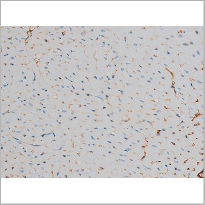 product-image-AAA31015_IHC7.jpg