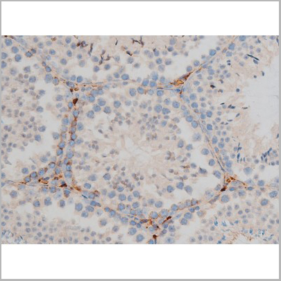 product-image-AAA31015_IHC8.jpg