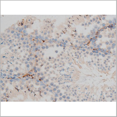 product-image-AAA31015_IHC9.jpg