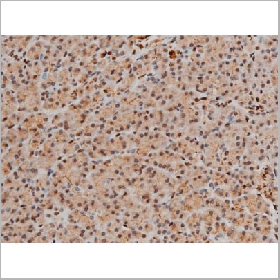 product-image-AAA31016_IHC10.jpg