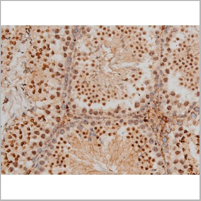 product-image-AAA31016_IHC11.jpg