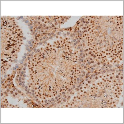 product-image-AAA31016_IHC12.jpg