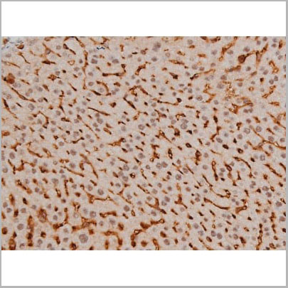 product-image-AAA31016_IHC13.jpg