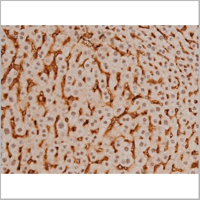 product-image-AAA31016_IHC14.jpg