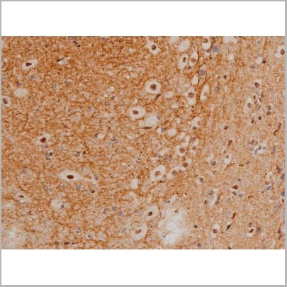 product-image-AAA31016_IHC15.jpg