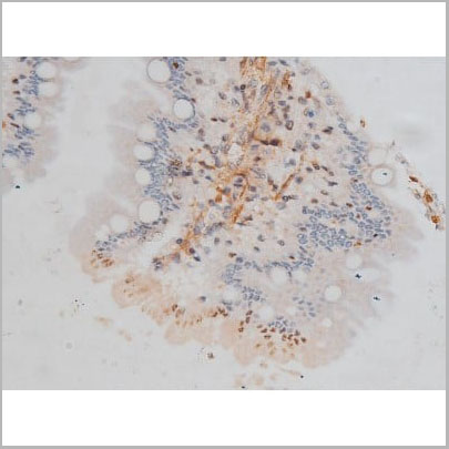 product-image-AAA31016_IHC18.jpg
