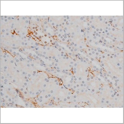 product-image-AAA31016_IHC20.jpg