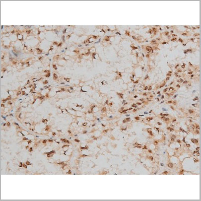 product-image-AAA31016_IHC5.jpg
