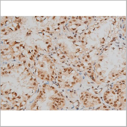 product-image-AAA31016_IHC6.jpg