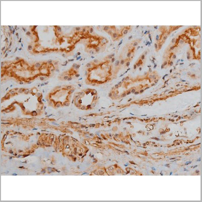 product-image-AAA31016_IHC8.jpg
