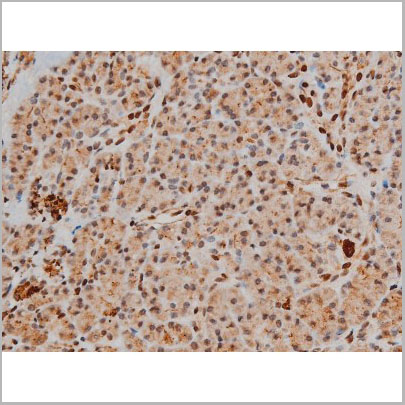 product-image-AAA31016_IHC9.jpg