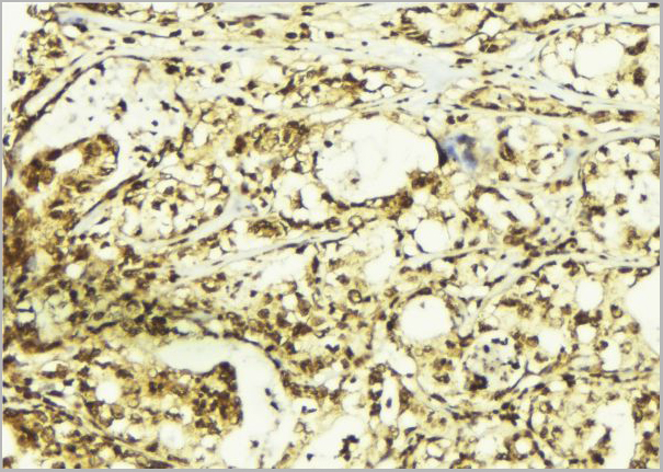 product-image-AAA31017_IHC5.jpg