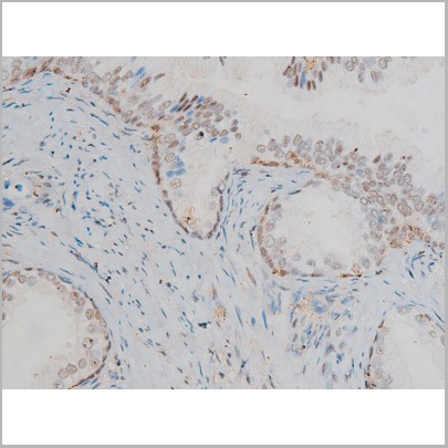 product-image-AAA31018_IHC2.jpg