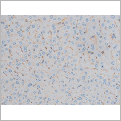 product-image-AAA31018_IHC3.jpg