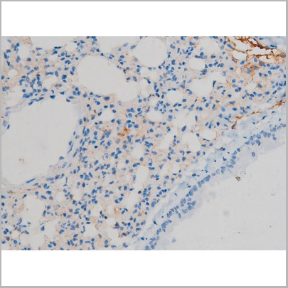 product-image-AAA31018_IHC4.jpg