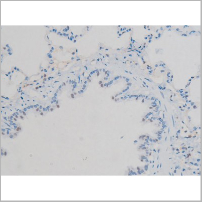 product-image-AAA31018_IHC5.jpg