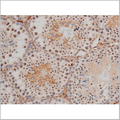 product-image-AAA31019_IHC10.jpg