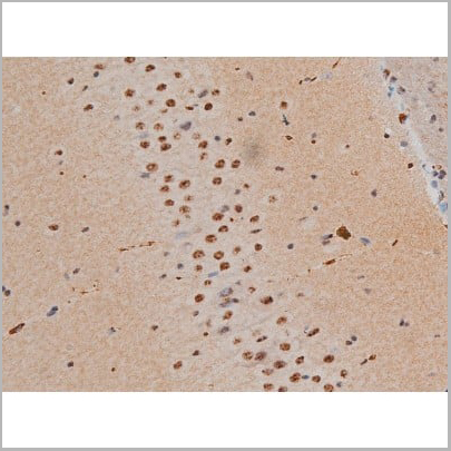 product-image-AAA31019_IHC11.jpg
