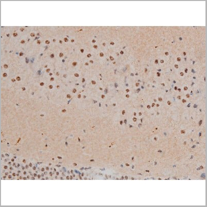 product-image-AAA31019_IHC12.jpg