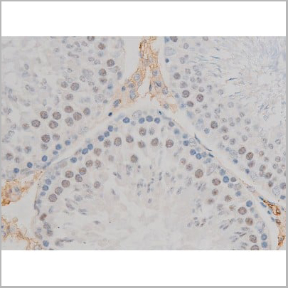 product-image-AAA31019_IHC13.jpg